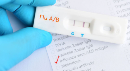 Influenza rapid diagnostic test background and treatment
