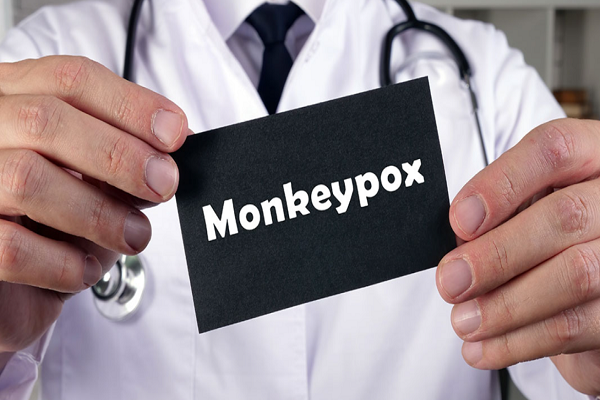 Rapid antigen detection test strep: five things you need to know about monkeypox